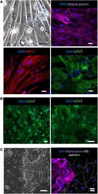 HiPS-Endothelial Cells Acquire Cardiac Endothelial Phenotype in Co-culture With hiPS-Cardiomyocytes